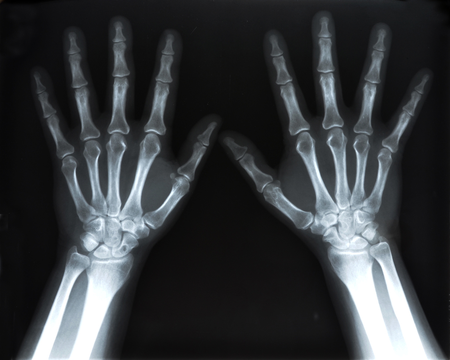 Create And Play An X Ray Matching Game Experiment Exchange