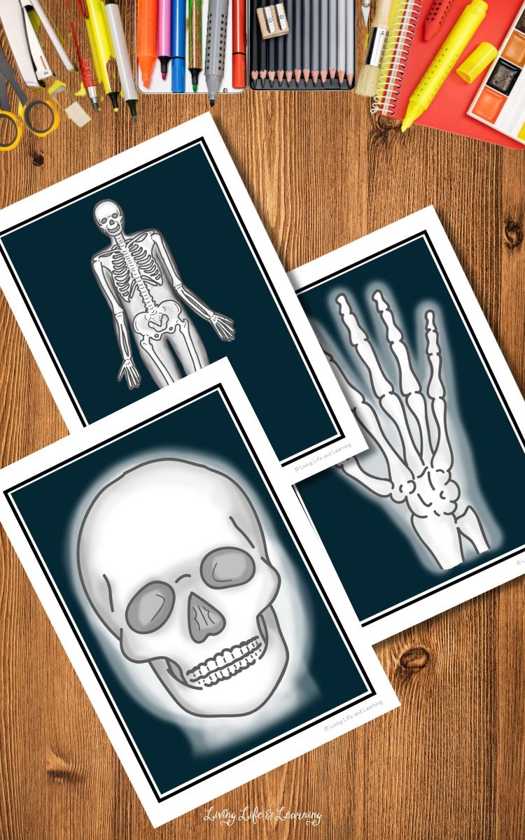 Printable X Ray Images