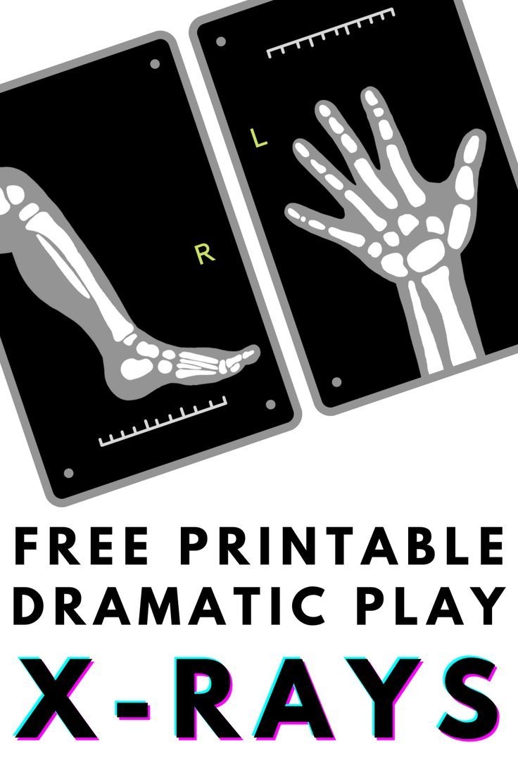 Printable X Ray Pictures