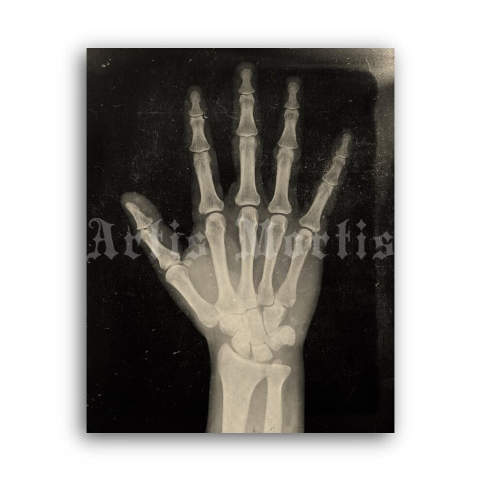 Printable X Ray Human Hand Anatomy Medical Radiology Poster